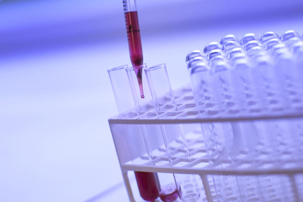 Glibioliquid es el primer marcador de tumores cerebrales en sangre. Fotografía de archivo.